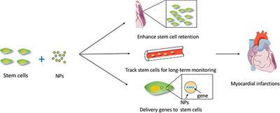 The Roles of Nanoparticles in Stem Cell-Based Therapy for Cardiovascular Disease